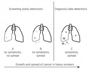 Graphic illustrating the growth of lung cancer